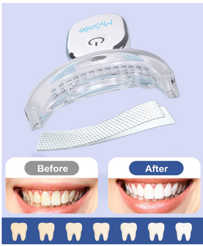 MySmile Teeth Whitening Kit w/LED Light + Teeth Whitening Strips